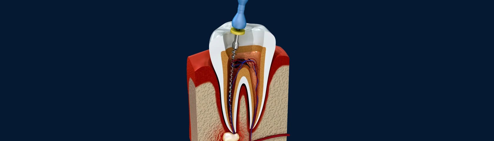 Studi Pellizzon Racco Servizi Endodonzia