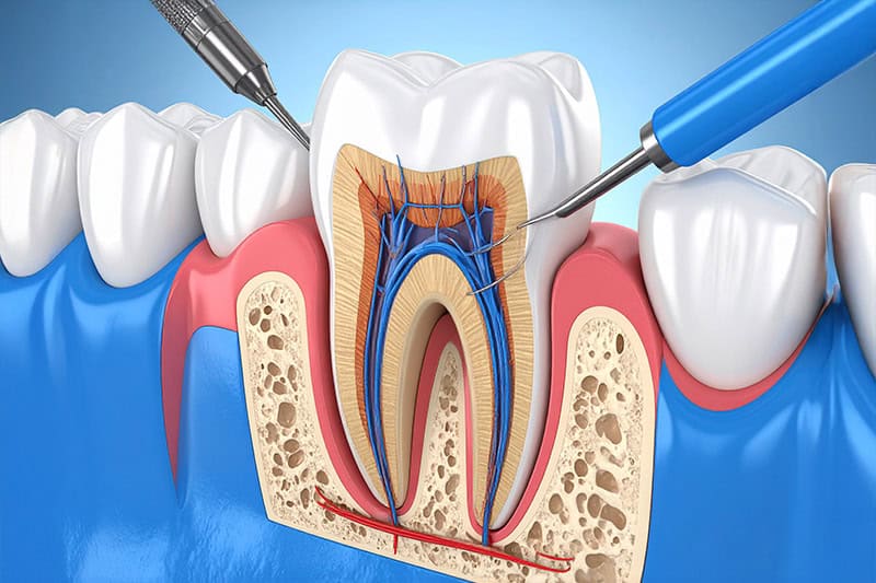 Studi Pellizzon Racco Servizi Odontoiatria Endodonzia
